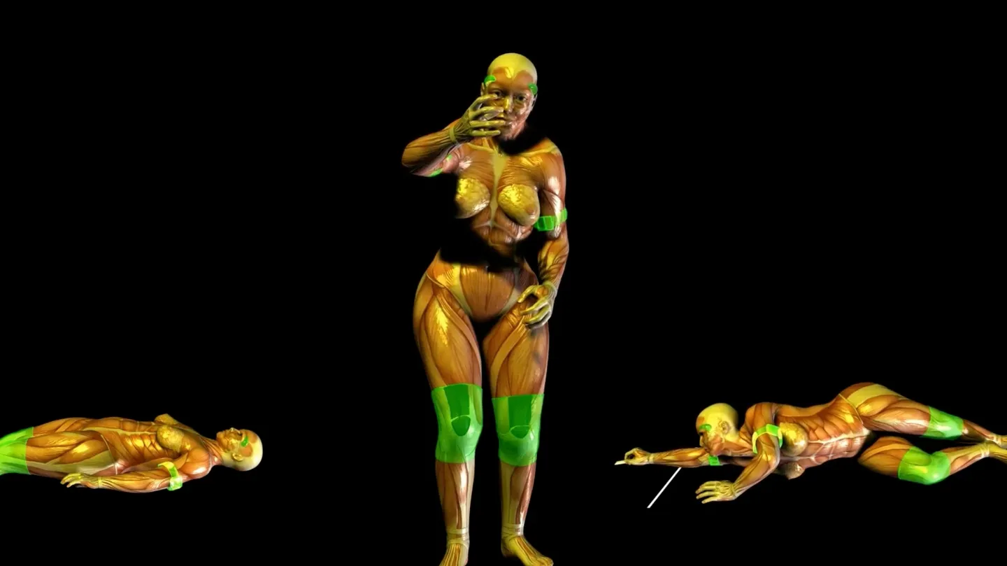 La liberté en écorchée by ORLAN