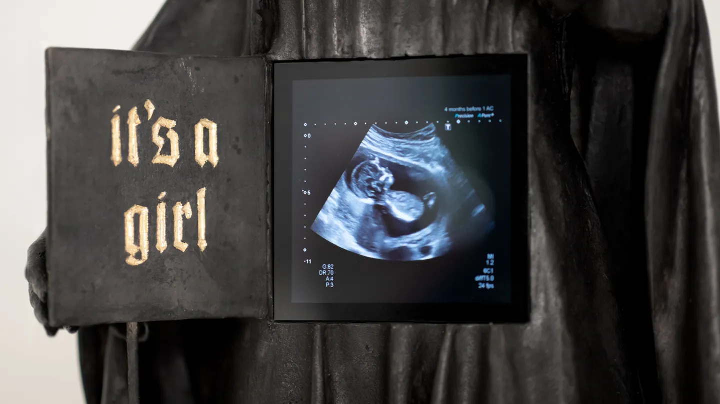 It's a girl by Sven Windszus