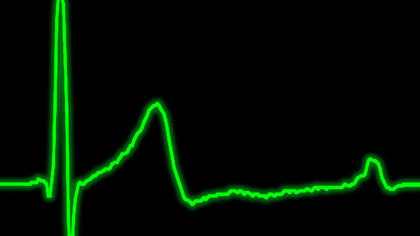 Heartbeat #3 by Pol Lombarte