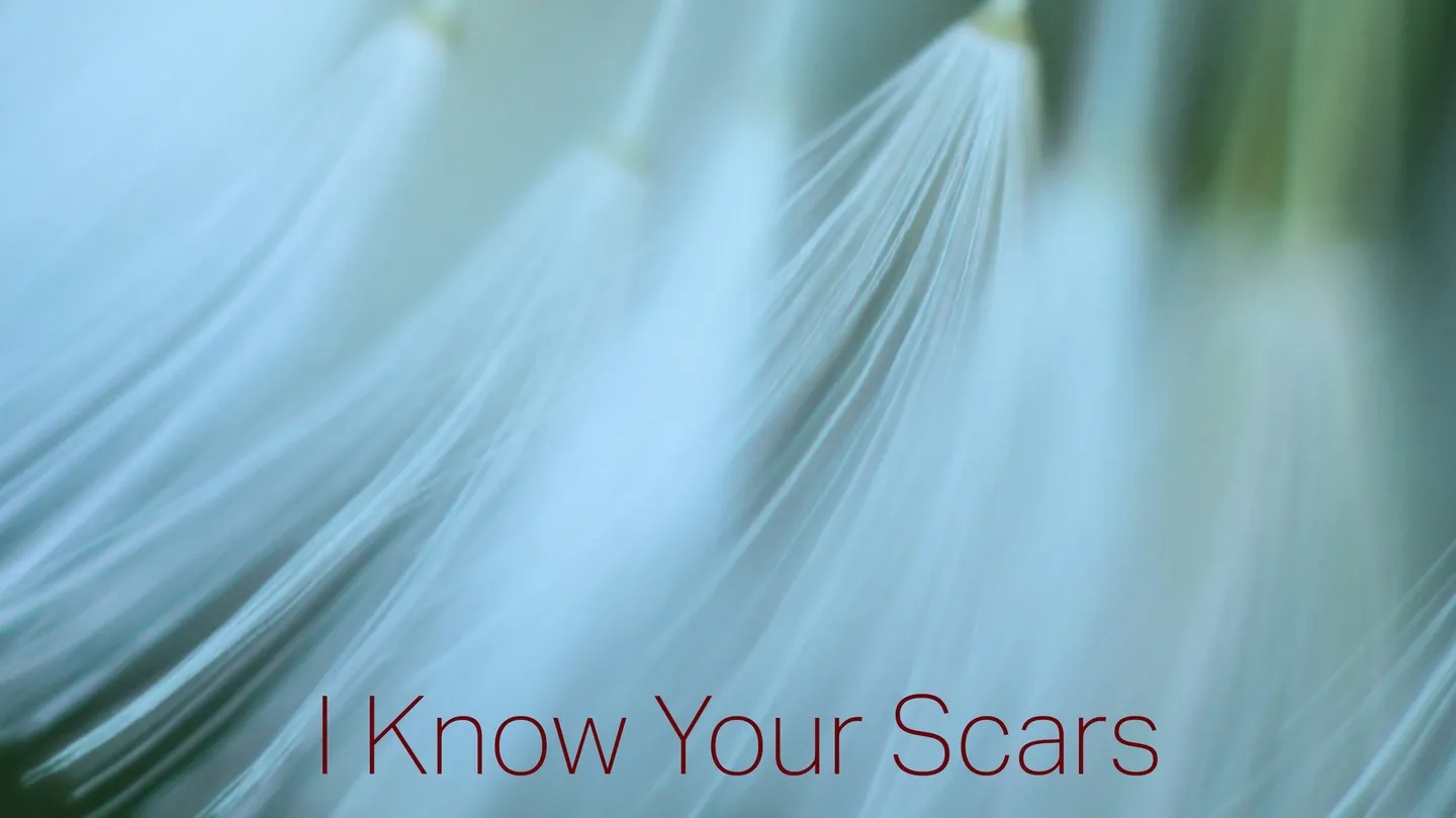 I know your scars by Dex Hannon