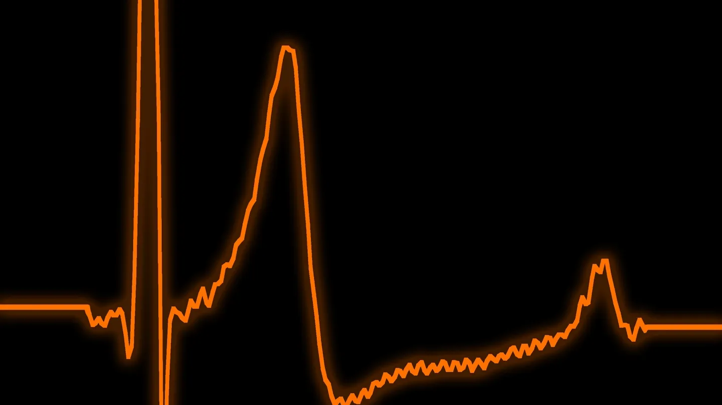 Heartbeat #1 by Pol Lombarte
